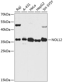 Western blot analysis of extracts of various cell lines using NOL12 Polyclonal Antibody at dilution of 1:3000.