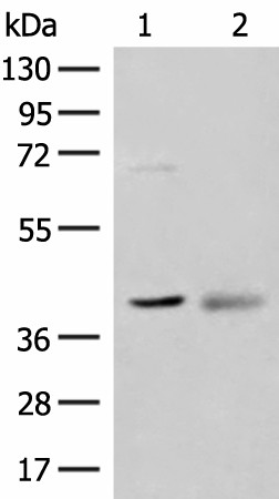 Western blot analysis of Mouse kidney tissue and Human fetal brain tissue lysates  using ADH5 Polyclonal Antibody at dilution of 1:500