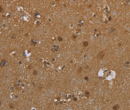 Immunohistochemistry of paraffin-embedded Human brain  tissue using SCGB1D2 Polyclonal Antibody at dilution 1:40