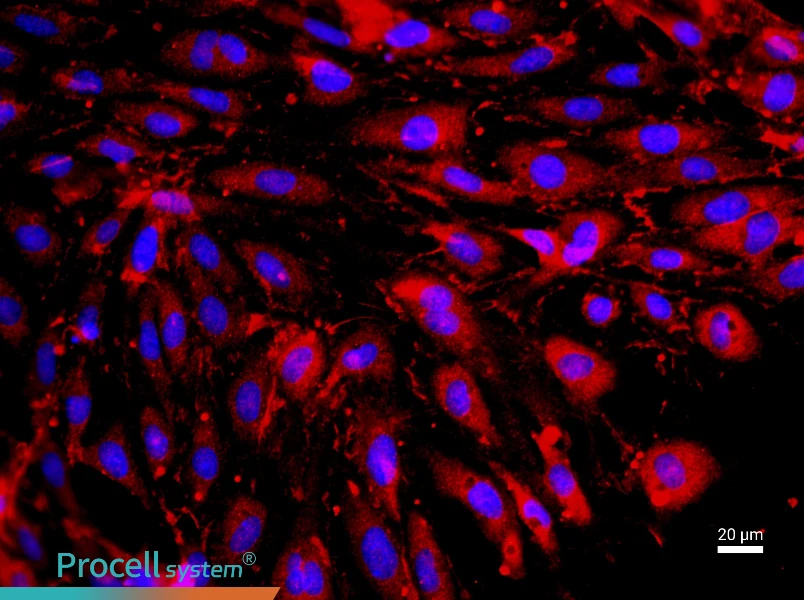 Rat Cardiac Microvascular Endothelial Cell Complete Medium - 2