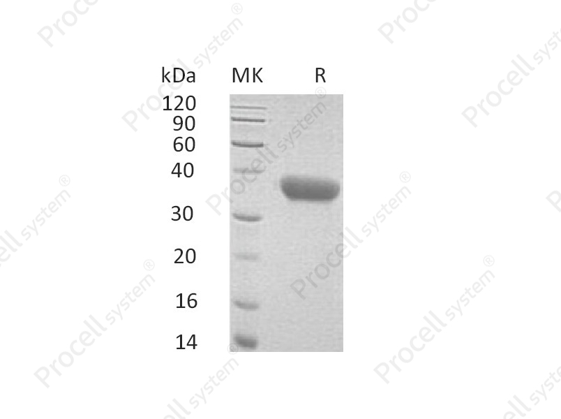 CXCL16/SR-PSOX (C-6His), Mouse, Recombinant