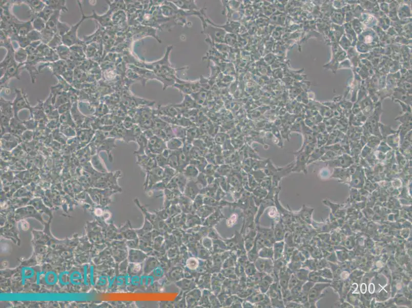 NCCIT Cell Complete Medium - 6
