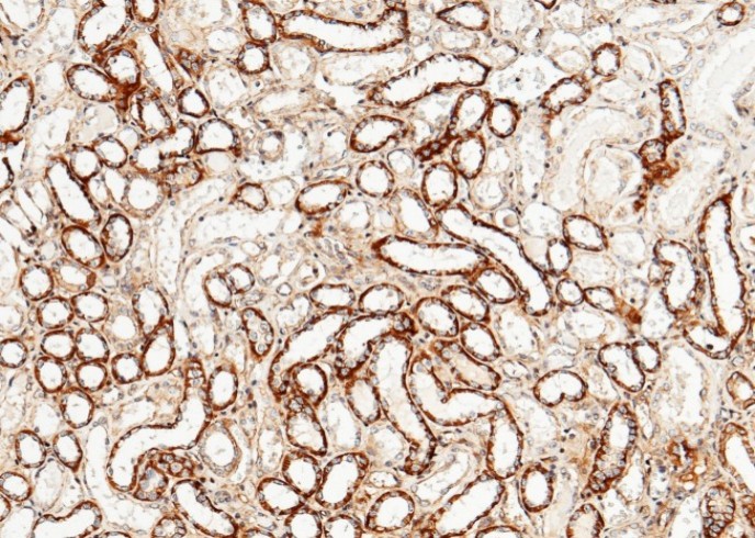 Recombinant CLEC3B/Tetranectin Monoclonal Antibody - small - 2
