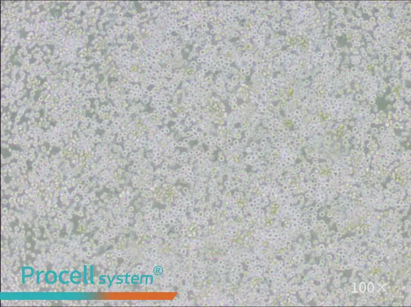 AE-2 Cell Complete Medium - 1