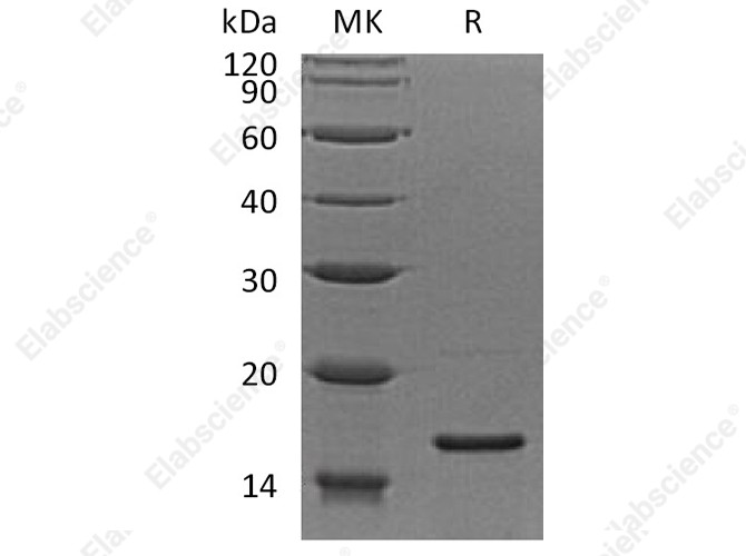 Recombinant Human RPS19 Protein - 1