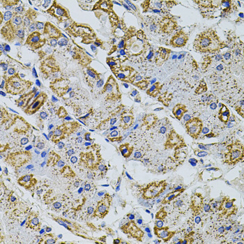Immunohistochemistry of paraffin-embedded Human stomach using Gm13125 Polyclonal Antibody at dilution of 1:100 (40x lens).
