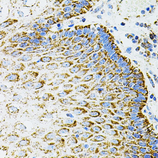 Immunohistochemistry of paraffin-embedded Human esophagus using EPO Polyclonal Antibody