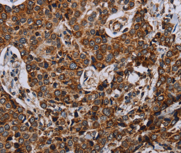 NDUFA4 Polyclonal Antibody - 3