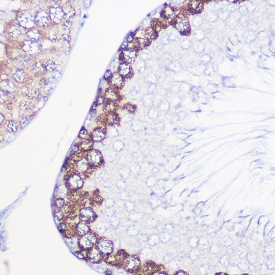 Immunohistochemistry of paraffin-embedded rat testis using DAZL Polyclonal Antibody at dilution of 1:100 (40x lens).Perform high pressure antigen retrieval with 10 mM citrate buffer pH 6.0 before commencing with IHC staining protocol.