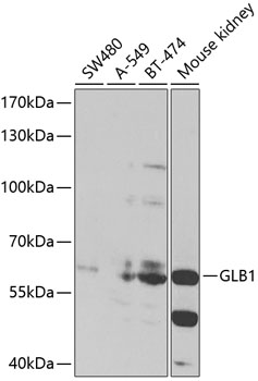 Western blot analysis of extracts of various cell lines using GLB1 Polyclonal Antibody at 1:1000 dilution.