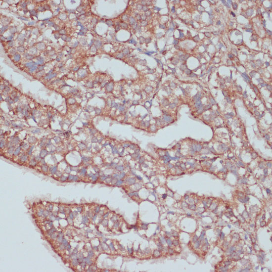 Immunohistochemistry of paraffin-embedded Rat ovary using MOB4 Polyclonal Antibody at dilution of  1:100 (40x lens).