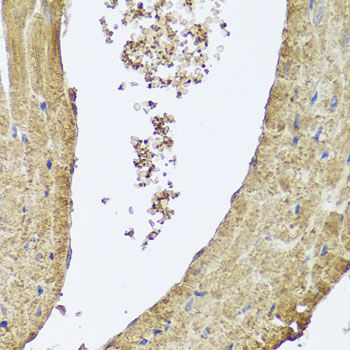 Immunohistochemistry of paraffin-embedded mouse heart using PIK3C2A Polyclonal Antibody at dilution of 1:100 (40x lens).Perform microwave antigen retrieval with 10 mM PBS buffer pH 7.2 before commencing with IHC staining protocol.