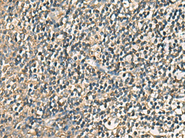 Immunohistochemistry of paraffin-embedded Human tonsil tissue  using VTA1 Polyclonal Antibody at dilution of 1:85(?200)