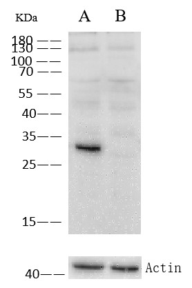 Recombinant Cathepsin D/CTSD Monoclonal Antibody - small - 4