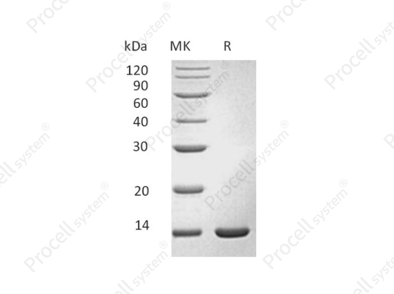 Interferon &gamma;/IFN-&gamma;/IFNG, Mouse, Recombinant