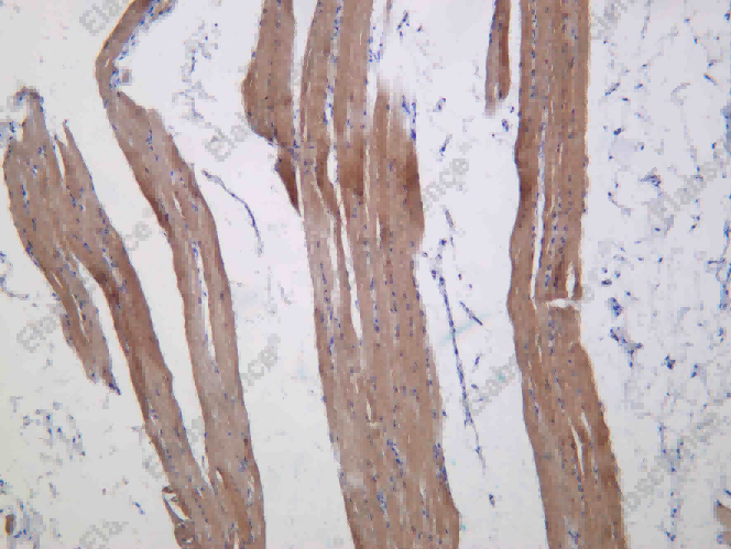 Recombinant ALP Monoclonal Antibody - 1