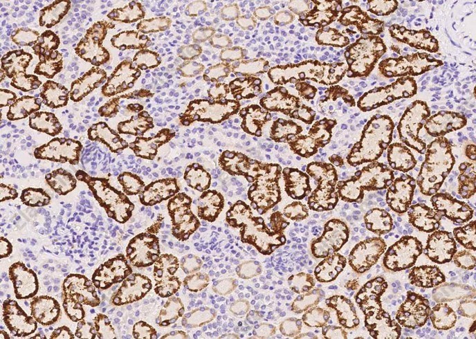 VISTA/GI24/B7-H5 Monoclonal Antibody - 1