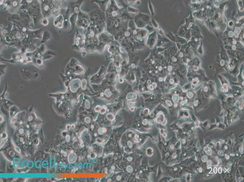 OE19 Cell Complete Medium - small - 4