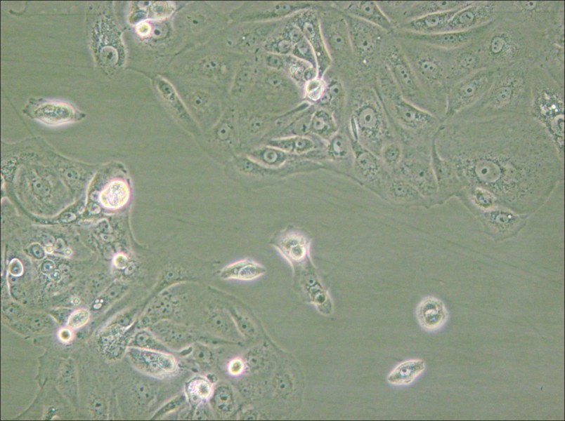 MKN-7 [MKN7; MKN 7] Cell Complete Medium - small - 5