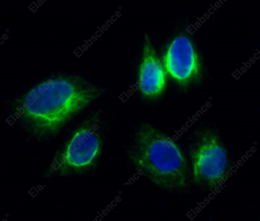 Recombinant Vimentin Monoclonal Antibody - 7