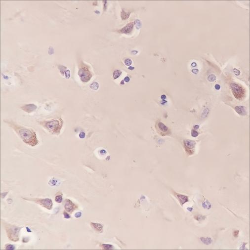 Recombinant MAP1LC3A Monoclonal Antibody - small - 2