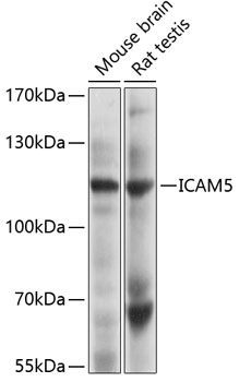 Western blot analysis of extracts of various cell lines using ICAM5 Polyclonal Antibody at 1:1000 dilution.