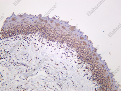 Recombinant c-Rel Monoclonal Antibody - 1