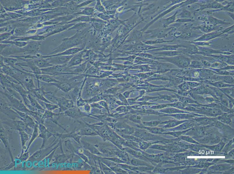 Human Bone Marrow Mesenchymal Stem (Primary cell immortalization) Cell Complete Medium - 5