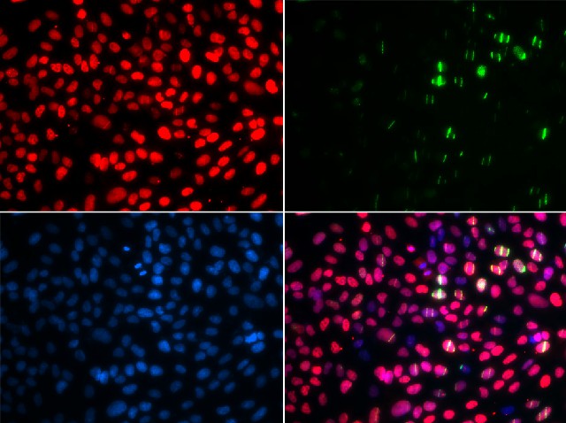 Immunofluorescence analysis of GFP-RNF168 transgenic U2OS cells using MSH6 Polyclonal Antibody