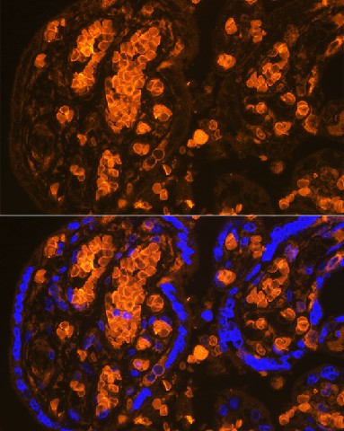 Immunofluorescence analysis of Human placenta using HBA2 Polyclonal Antibody at dilution of 1:100 (40x lens). Blue: DAPI for nuclear staining.