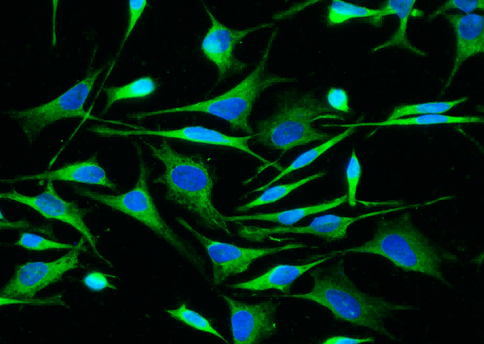 Recombinant ALDH7A1 Monoclonal Antibody - small - 2