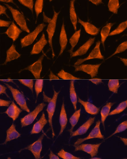 Immunofluorescence analysis of L929 cells using LHPP Polyclonal Antibody at dilution of  1:100. Blue: DAPI for nuclear staining.