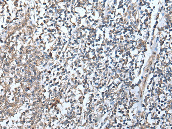 Immunohistochemistry of paraffin-embedded Human tonsil tissue  using DEFB104A Polyclonal Antibody at dilution of 1:50(?200)