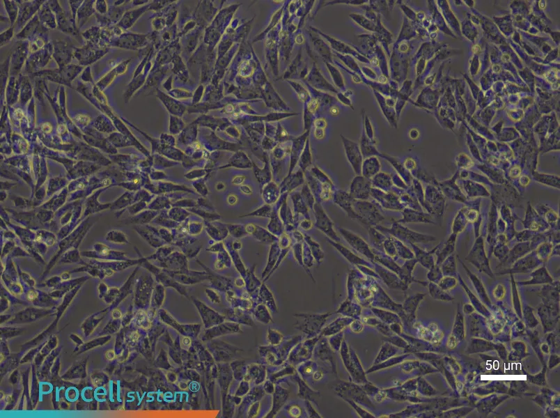 Rat Endometrial Stromal Cells - 4