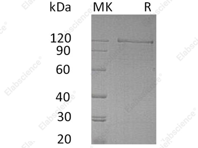 Recombinant Human NRCAM Protein (Fc Tag) - 1