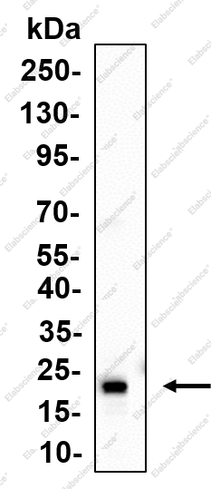 Recombinant LAMTOR1/C11orf59 Monoclonal Antibody - 2