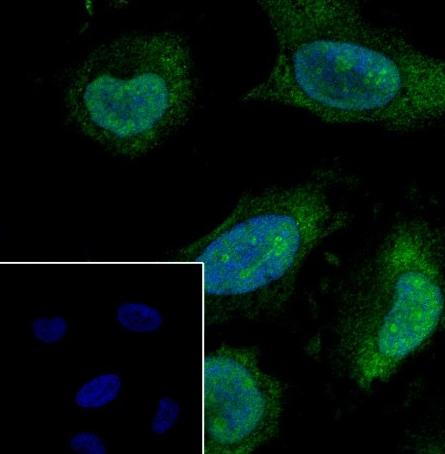 Recombinant HMGB2 Monoclonal Antibody - small - 5