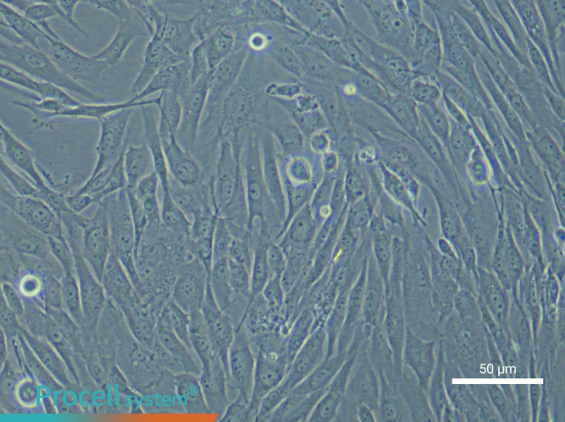 Human Intervertebral Disc Nucleus Pulposu (Primary cell immortalization) Cell Complete Medium - small - 5