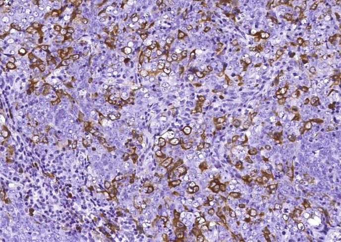 Recombinant RRM2B/P53R2 Monoclonal Antibody - small - 2