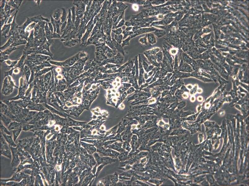 Y1 [Y-1] Cell Complete Medium - 5