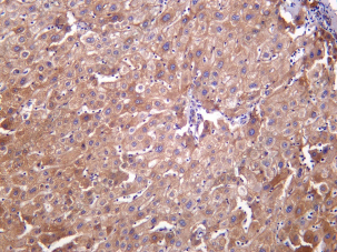 Recombinant E-cadherin Monoclonal Antibody - 1
