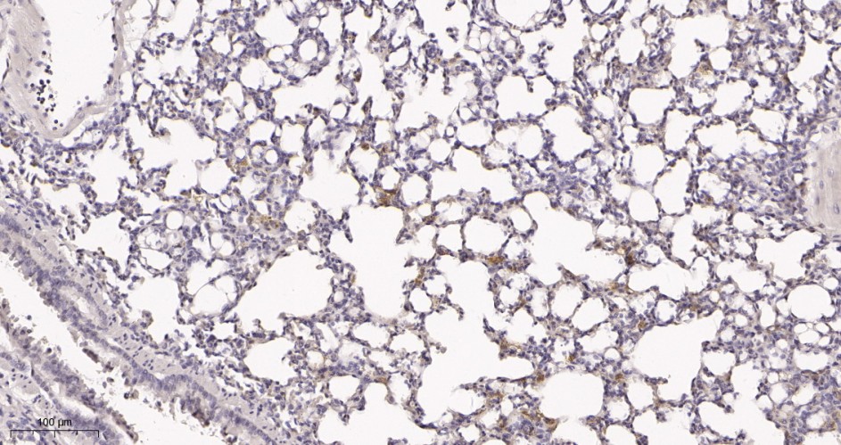 Recombinant Cytokeratin 5 Monoclonal Antibody - small - 3
