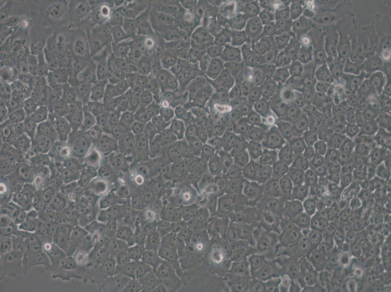 SACC-83 Cell Complete Medium - 6