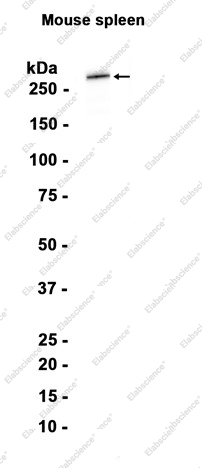 Recombinant smooth muscle Myosin heavy chain 11 Monoclonal Antibody - 1