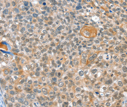 ALDOB Polyclonal Antibody - 2
