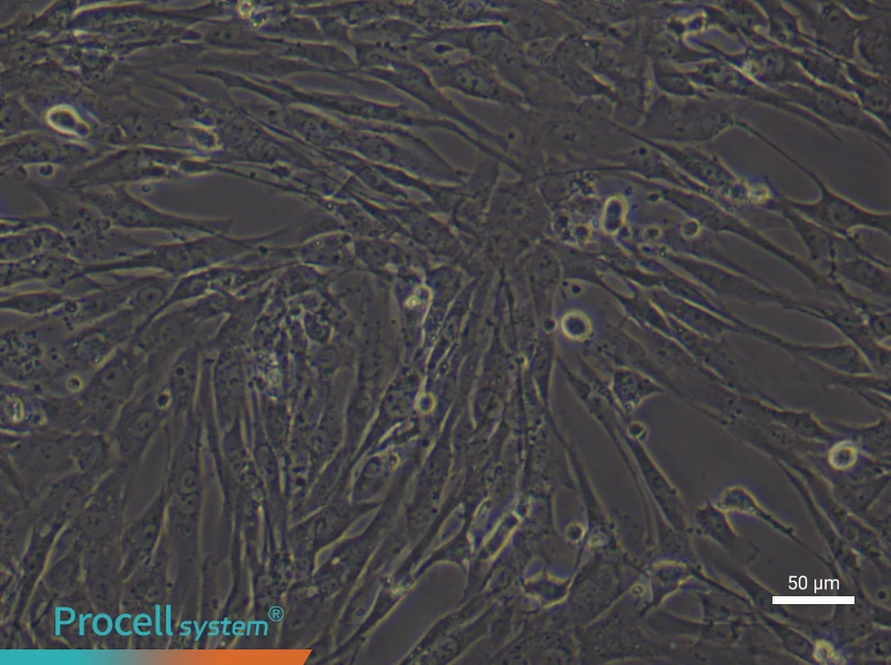 Human Lung Fibroblast (Primary cell immortalization) Complete Medium - 6
