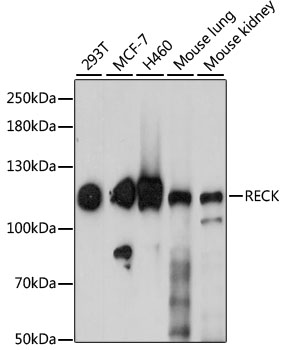 Western blot analysis of extracts of various cell lines using RECK Polyclonal Antibody at 1:1000 dilution.