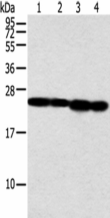 Western blot analysis of Jurkat and A549 cell human fetal liver tissue and hela cell  using NDUFB9 Polyclonal Antibody at dilution of 1:350