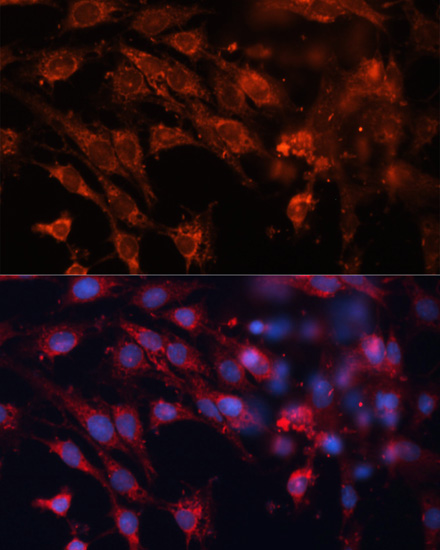 Immunofluorescence analysis of C6 cells using Cation-independent M6PR (Cation-independent M6PR (IGF2R)) Polyclonal Antibody at dilution of 1:100. Blue: DAPI for nuclear staining.