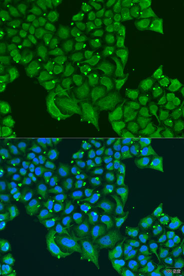 Immunofluorescence analysis of U2OS cells using ATPIF1 Polyclonal Antibody at dilution of 1:100. Blue: DAPI for nuclear staining.